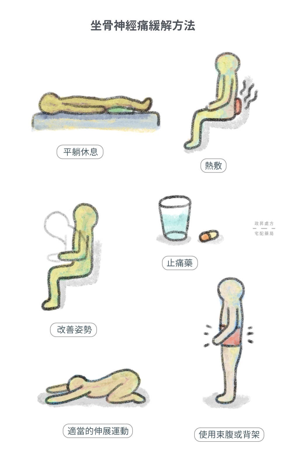 坐骨神經痛的6個緩解方法